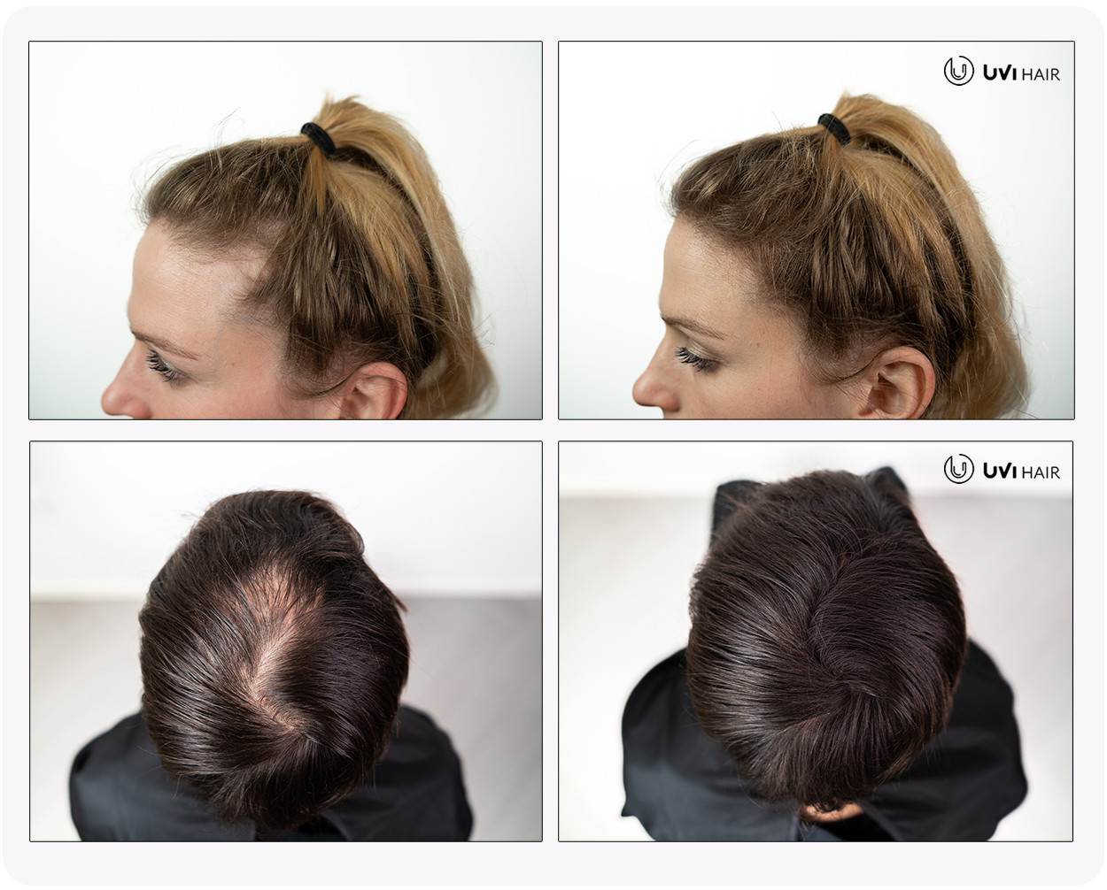UVI Hair vlakna za kosu, AUBURN / Kestenjasta (velika 27,5 g, do 50 nanosa) - Slika 2